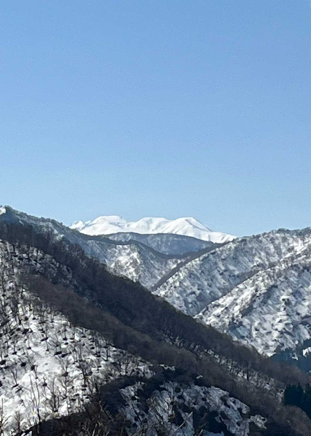 拡大