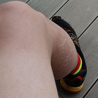 トレランのとき泳いだせいか
皮むけえぐすぎ

日焼けあんましないんだけど、
今年の夏はずっと外いるからやばい