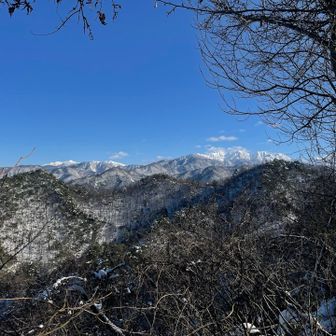 ハゲはまたいつか