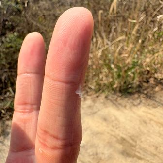 薄皮一枚負傷ッ！
重症です…😭