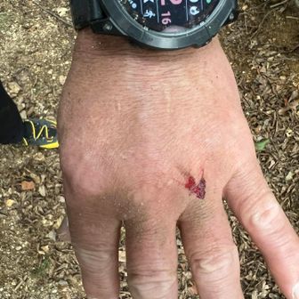 実はポールが雪山用になってて。スタートした時から木の根っこや枝にポールが引っかかって気になってた。
そしたらまさかこんな事に・・・