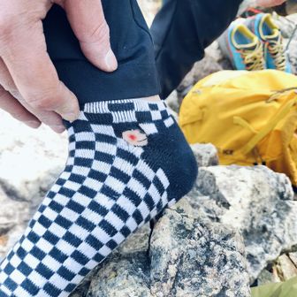 痛そう
靴下が身代わりに