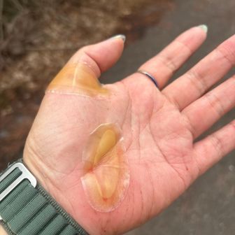 傷パワーパッドて応急処置
今日は水持ってなくて汚れを流す事も出来ず…
気を取り直し、下山再開