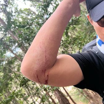 最後の最後
ハライド登山口へ下山中にポールが引っかかった時体勢崩して5mほど滑落しました。
こうやって落ちていくんだーって感じ。
ポール曲がってしまいましたー。




