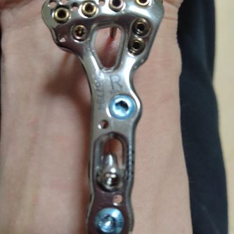 チリチリ