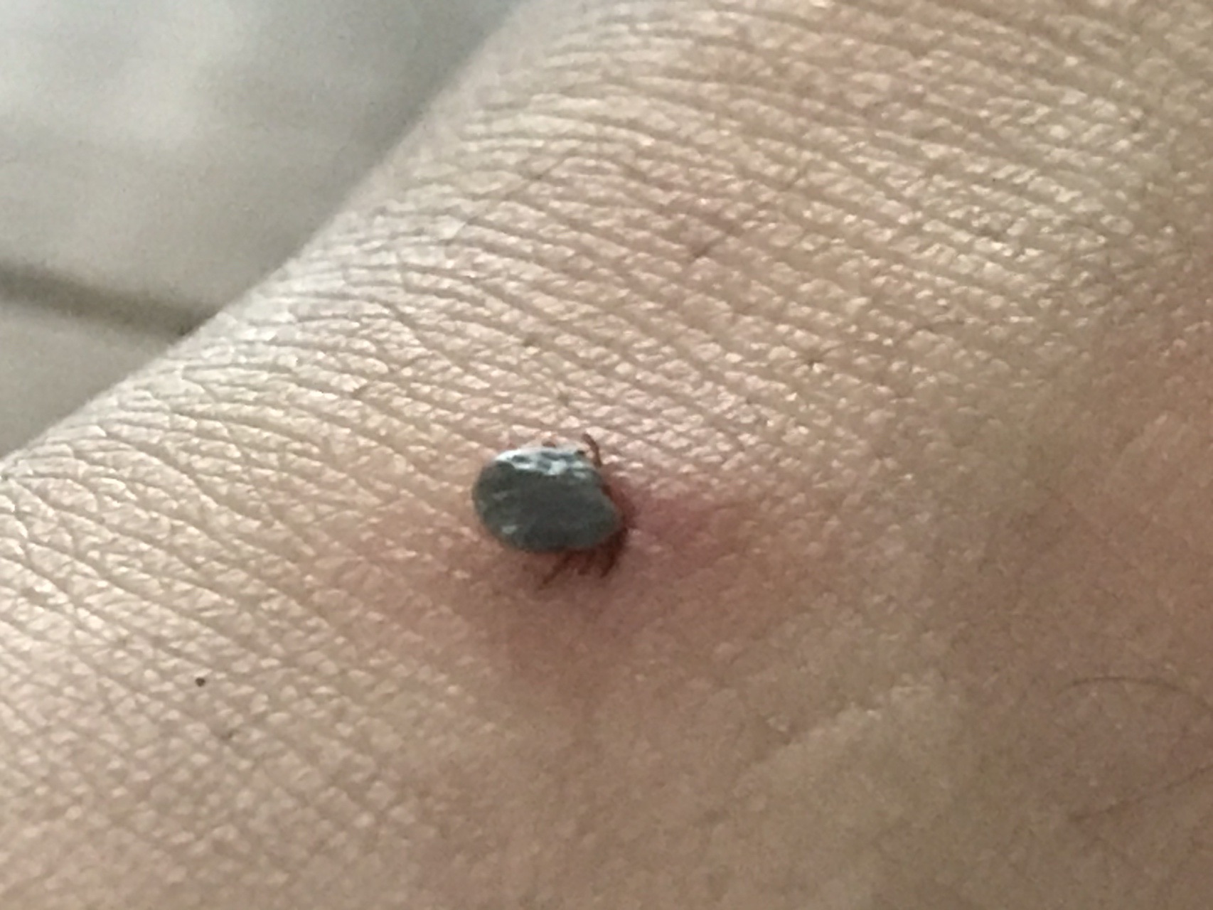 マダニに注意です かずみ さんの岩屋山 長崎県 舞岳の活動日記 Yamap ヤマップ