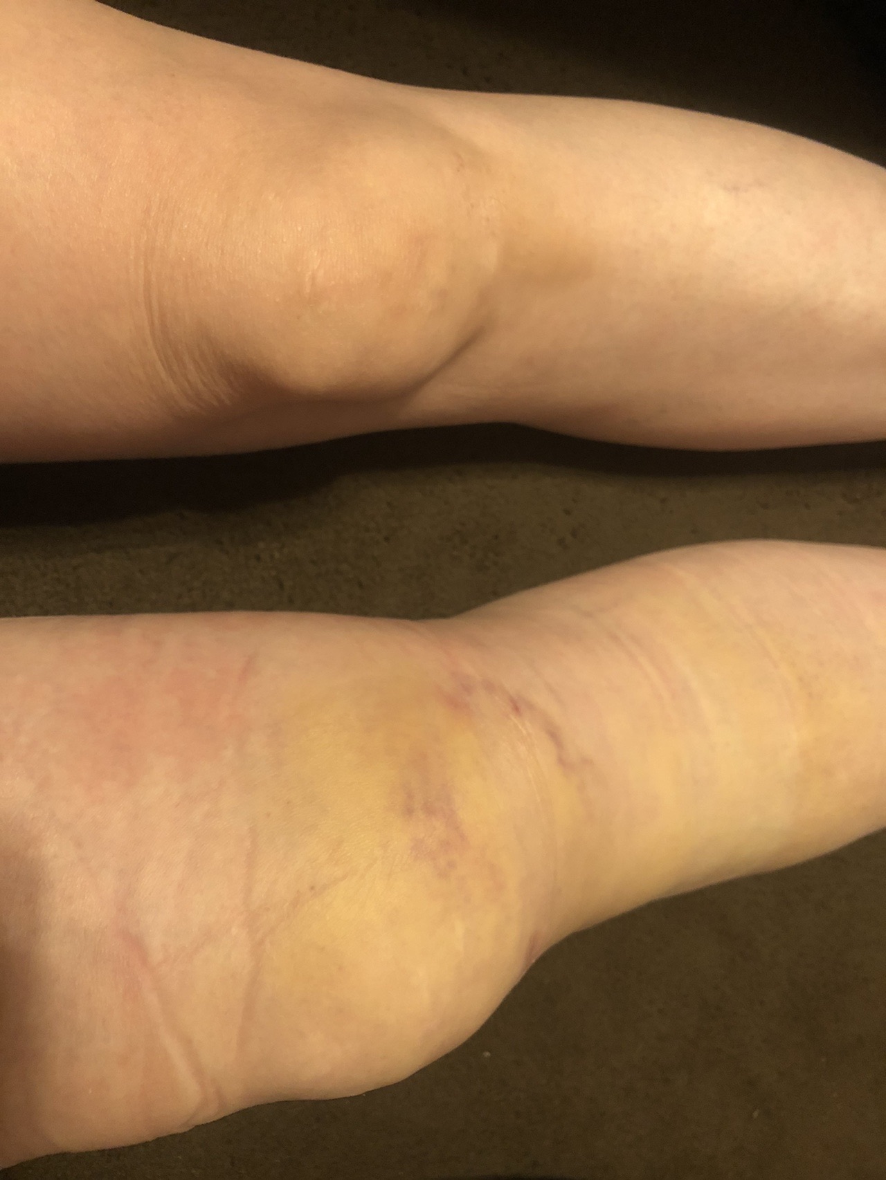 近況です 早く山にいきたーい Yukachi さんの笠置山 京都府 の活動日記 Yamap ヤマップ