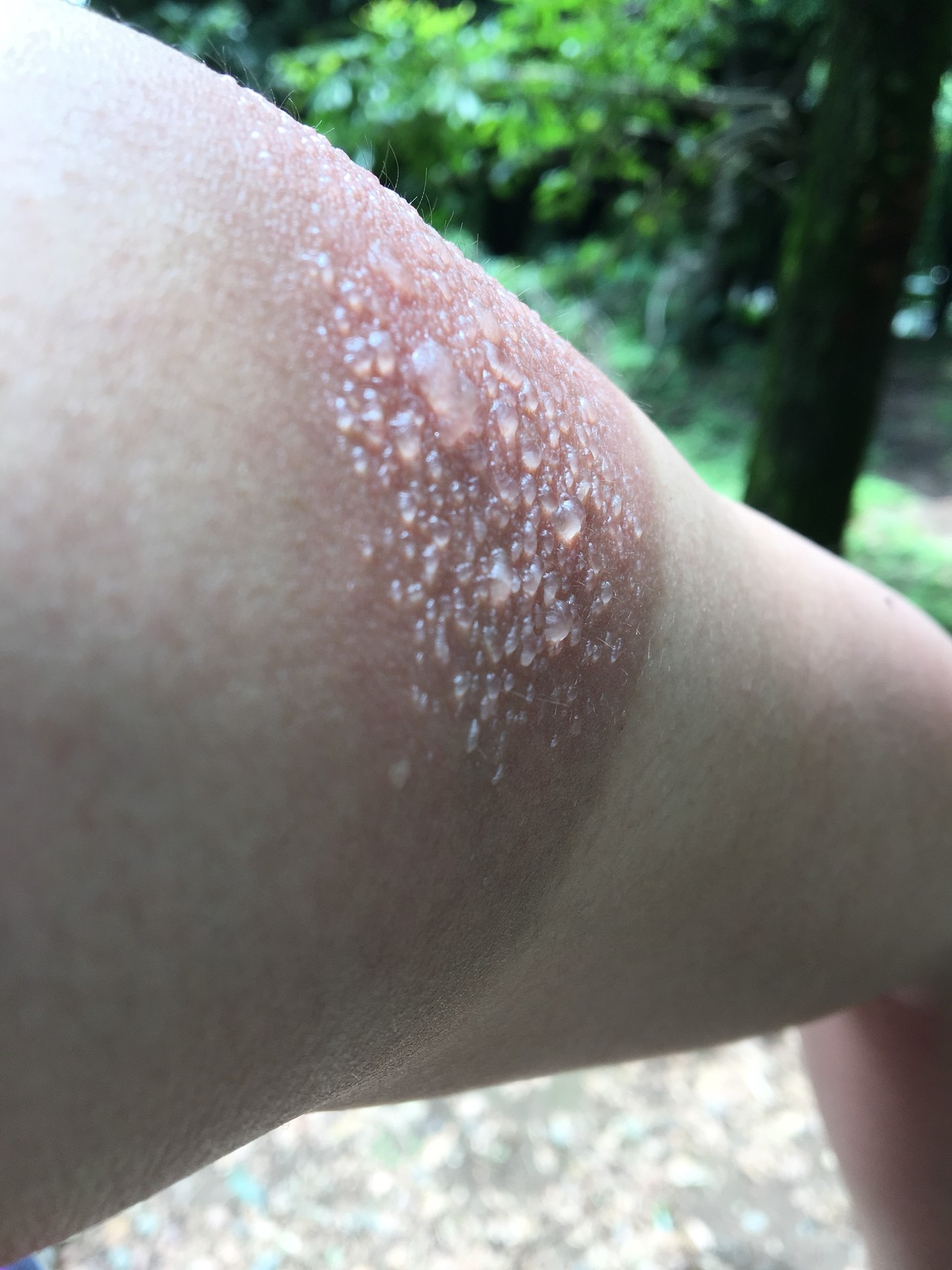 夢やぶれて 今が楽しければok さとさんの熊本市 中央エリア 北エリア の活動日記 Yamap ヤマップ