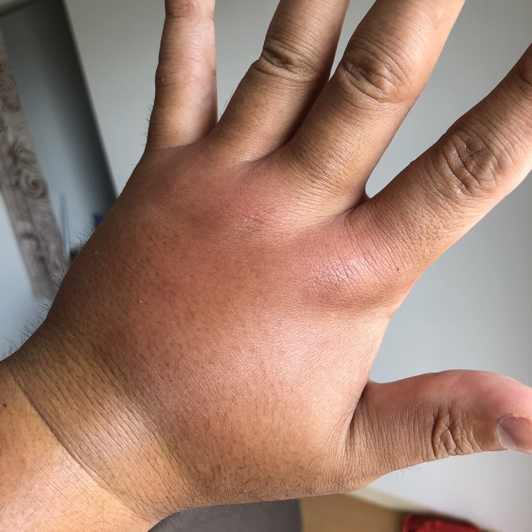 パンパンに晴れてるんだけれど 何の虫かわ Str Satoさんのモーメント Yamap ヤマップ