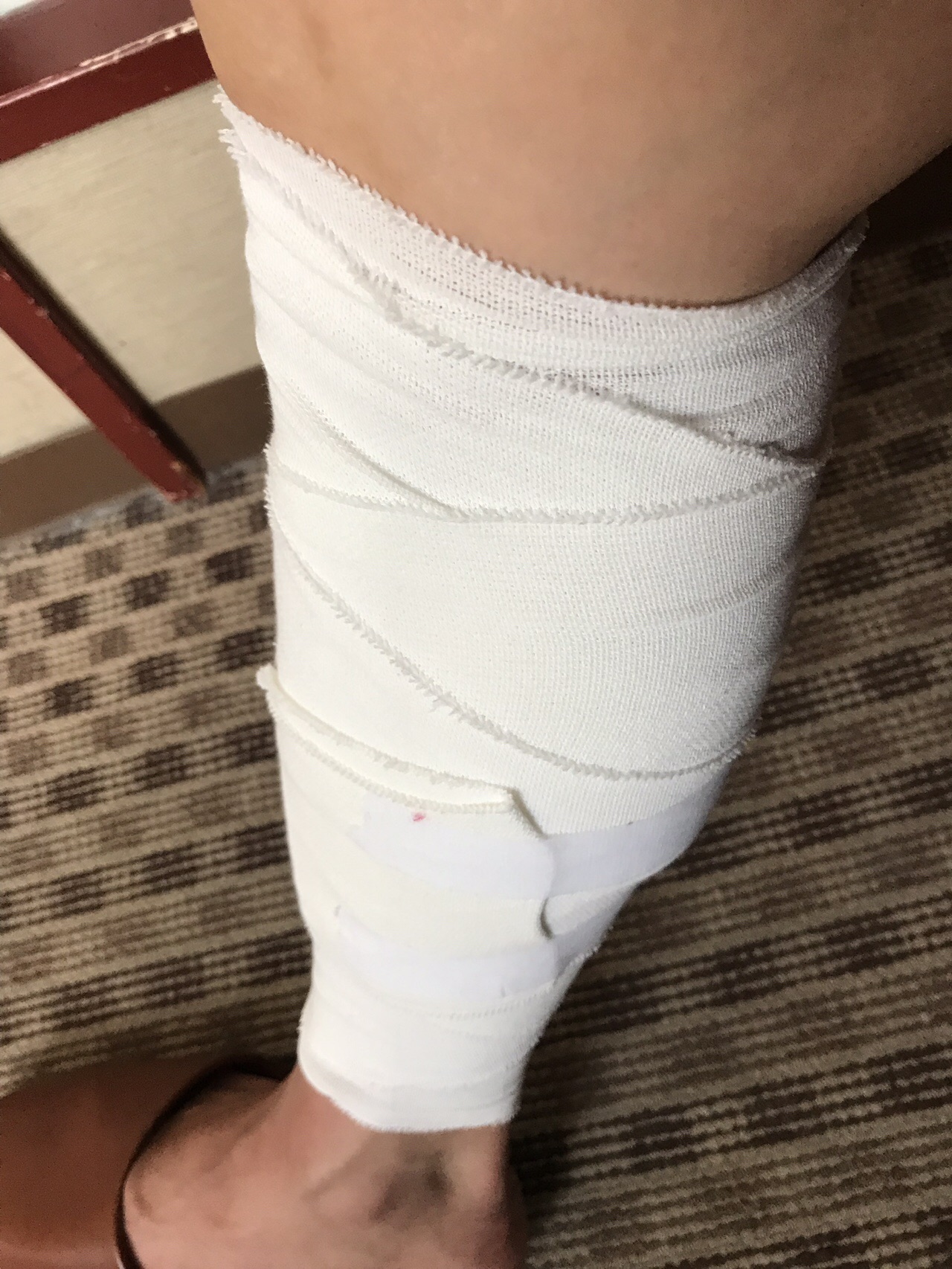 肉離れ 体験記 40日間 一生懸命はやめられない アキラマンさんの神戸市の活動データ Yamap ヤマップ