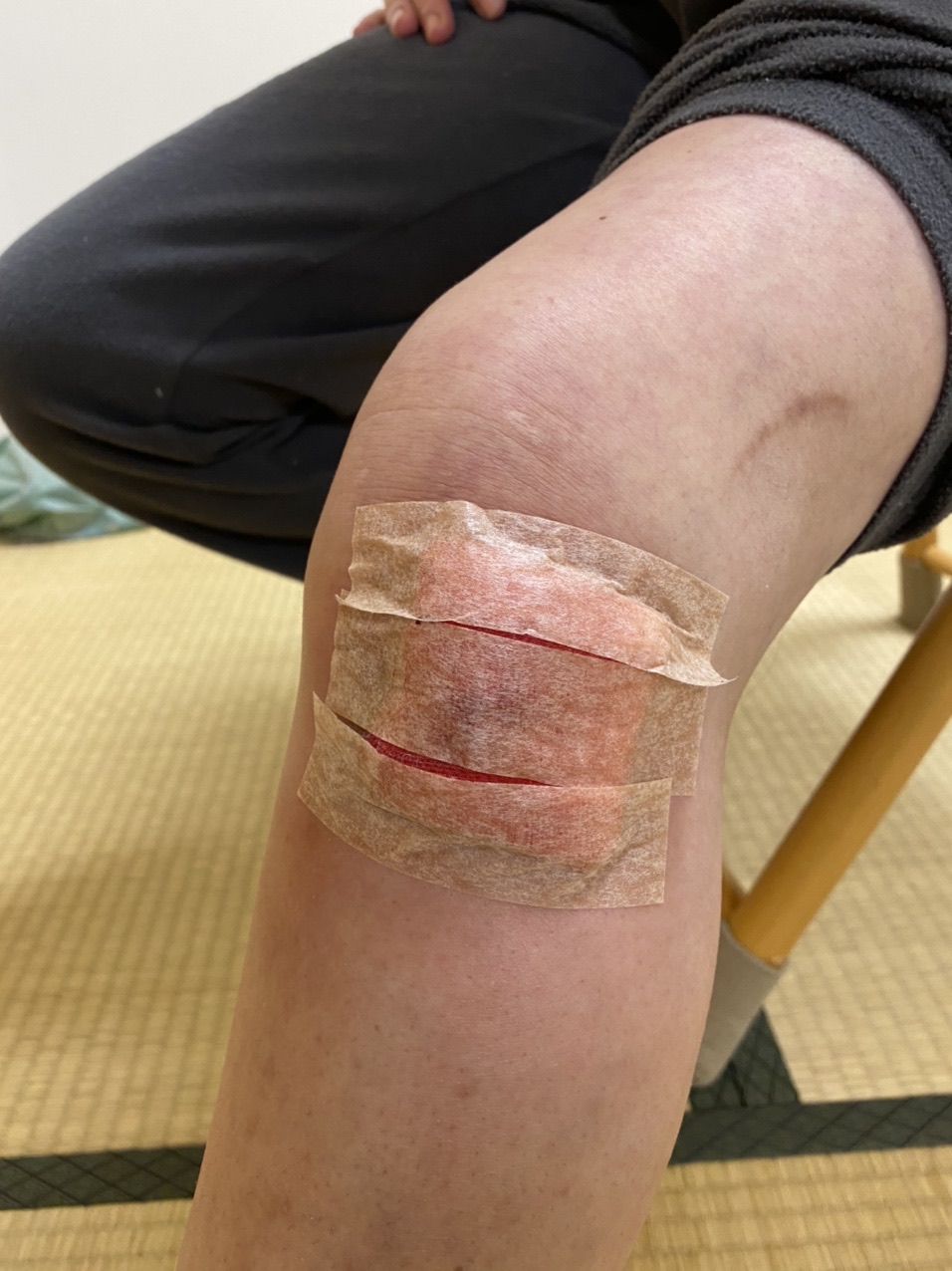 閲覧注意 汚い生脚 リーダーちゃんさんのモーメント Yamap ヤマップ