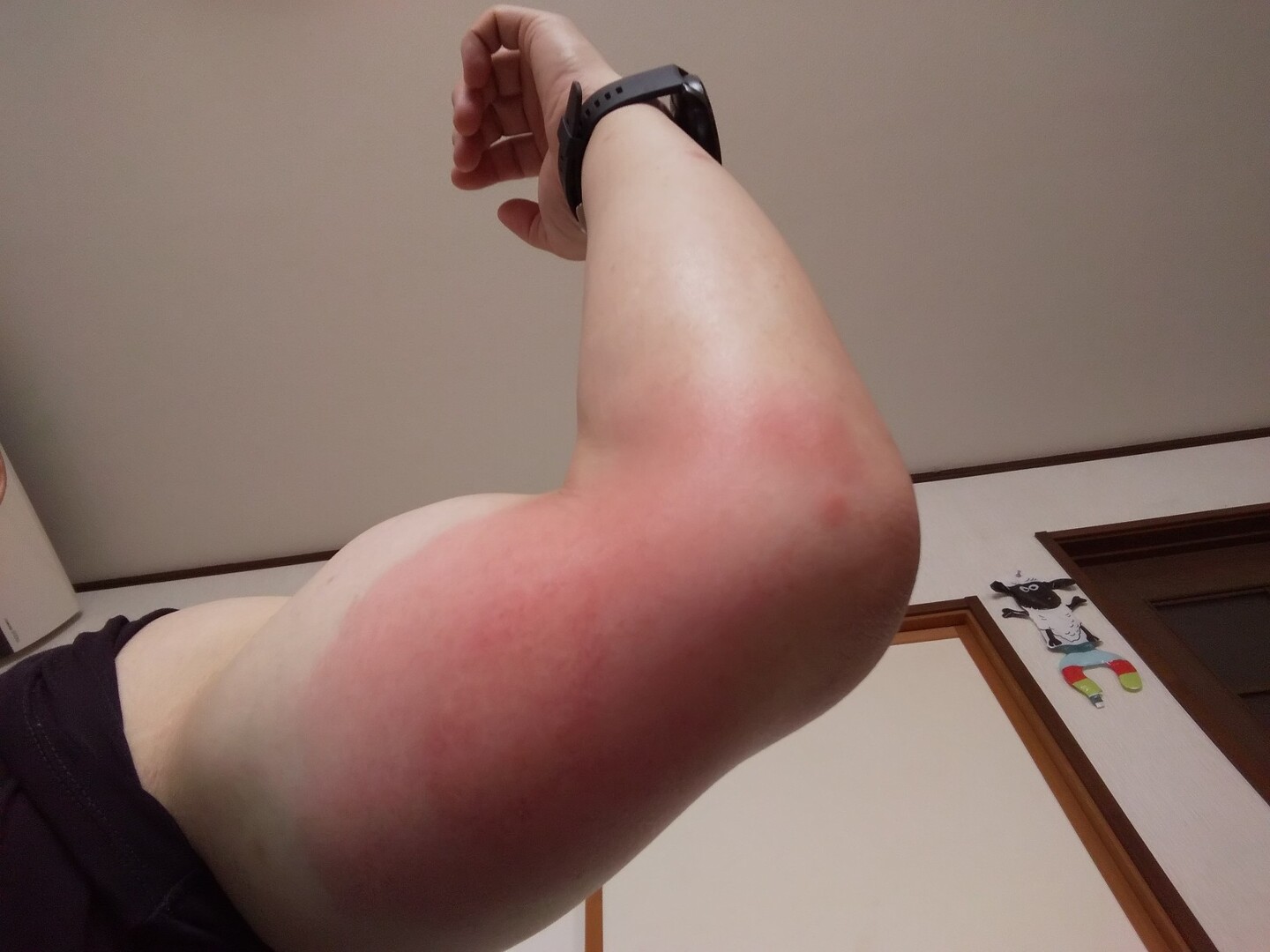 昨日の平ヶ岳でブヨに刺された ブヨ オ Ematoyouさんのモーメント Yamap ヤマップ