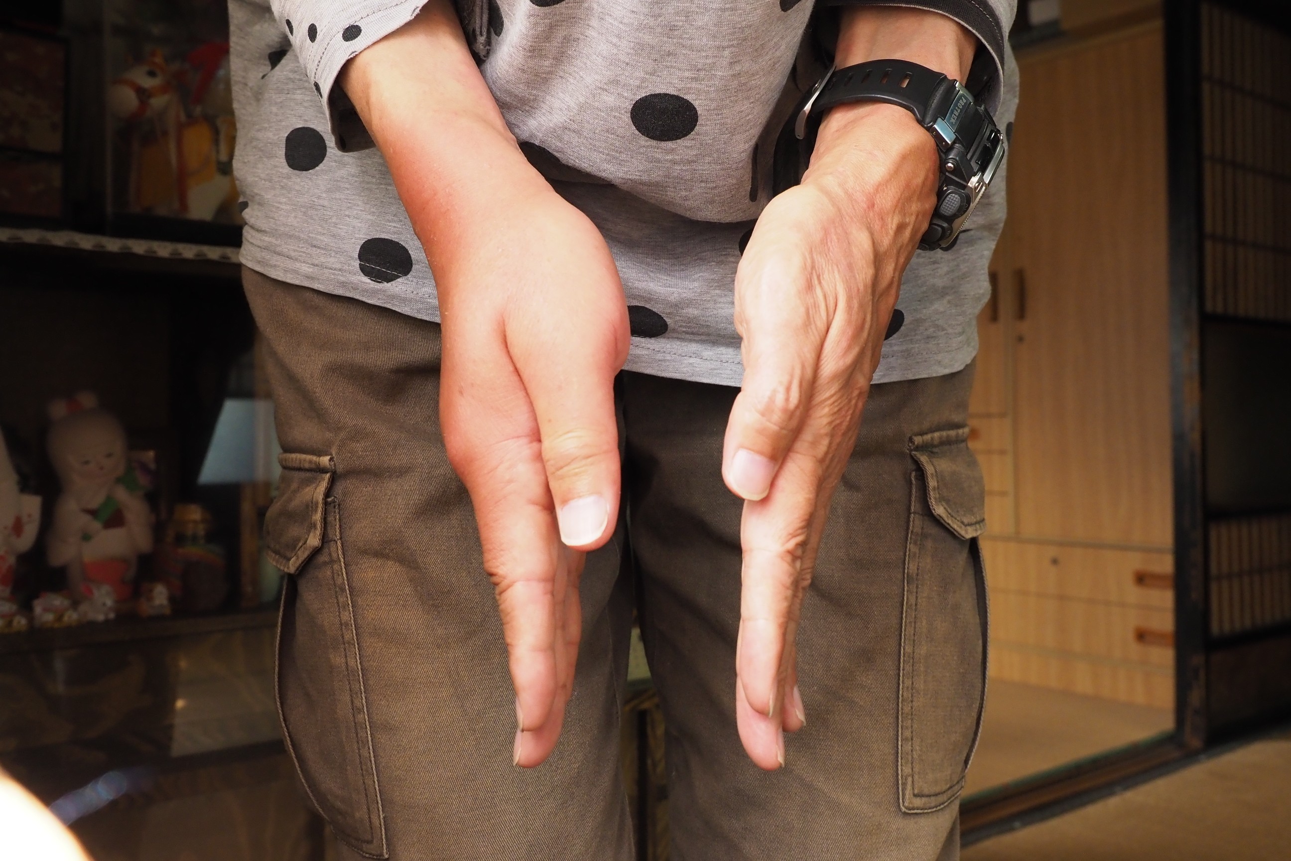 木六山・銀次郎山 厚さが1.5倍くらいに